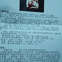 帮忙看一下男宝还是女宝啊