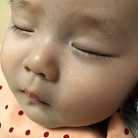 谁能告诉我内眼角下面是起的什么子子呀？要紧吗？