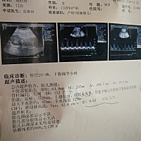 胎盘低，昨晚走多了肚子痛，幸好没什么事✌✌✌