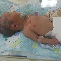 11月23号出院了，自己先回去的，求着医生给照了相片，看着儿子耳朵心痛，儿子还在新生儿科，肚子有...