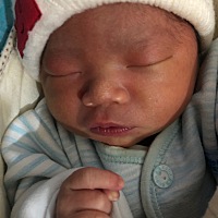 新生儿黄疸14.5算高嘛？ 宝妈们，求告诉有啥办法退黄疸呢？