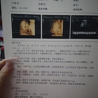 检查4维折腾了一下午，又是爬楼梯又是吃巧克力，看个脸不容易，最后医生说是个儿子，我喜欢闺女