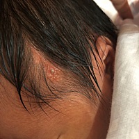 宝宝头上是什么东西啊