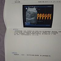 万能的圈子，看下小孩会小吗？孕晚期好难受，现在老觉的小肚子下痛，能看出男女吗？求发动，宝宝想什么...