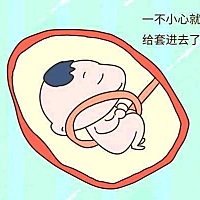 脐带绕颈对顺产有影响吗？ 脐带绕颈的情况是常见的，有宝宝脐带绕一周，有的宝宝会绕两周。脐带绕颈...