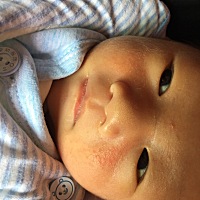 宝妈们知道宝宝这脸上起的是啥？要买什么东西回来擦？是不是妈妈上火了？