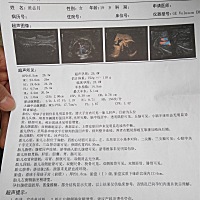 第一次跟宝宝见面☺☺