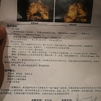 今天刚做完大排畸。