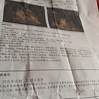 现在5个多月宝宝好动。四维能看懂吗？男女的第一个是女孩
