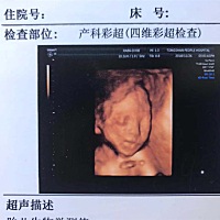 做四维的前天晚上，梦到自己七个月就自然生产了，宝宝很健康，是个女宝，大家好高兴的。四维做出来，宝...
