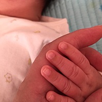 宝妈们看看我儿子的手指甲上面的皮肤有点发黑.有知道咋回事的吗？自从生了宝宝以后发现有一点不对劲就各...