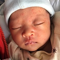 宝妈们 请问宝宝这是湿疹还是痱子啊