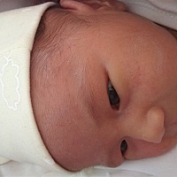 宝宝脸上额头长了好多痘痘，有什么好办法宝妈们