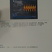 求发动，淡定宝宝什么时候才发动，在我肚子里呆够没？有谁懂看B超的，看下孩子有几斤重？宝宝现在后期动...