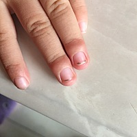 小孩子的指甲有知道怎么回事的吗？