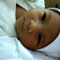 宝妈们，今天给宝宝测试黄疸值数20严重吗，有没有宝妈的宝宝黄疸高的，要怎么去黄疸。