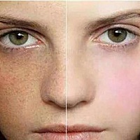 m 爱美是每个人的天性，谁都喜欢把自己打扮的漂漂亮亮的。在这个看脸的社会，你皮肤可以不够白，但最少...