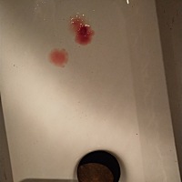 今天见红了   明天预产期  需要去医院吗？