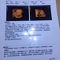 通过四维可以看出男女么？