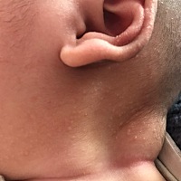 宝宝三个月，奶粉，这是起的啥呀，各位亲们有知道的吗，应该用点啥，脸还有点干，擦霜了也不管用，用啥...