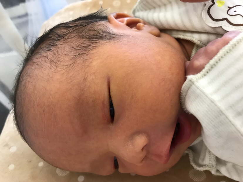 我的小公主，现在有点生理性黄疸。