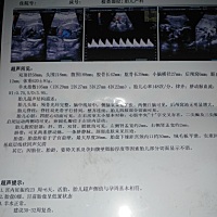 好奇，帮忙看看男女