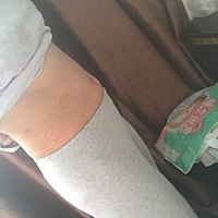 二胎宝宝十天啦，40+3出生女宝，一胎刨的，二胎顺产七斤，一胎和二胎间隔两年，当天中午十一点肚子疼，...