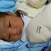 有宝妈懂的吗？请教一下 宝宝这两天脸跟眼白有点黄 是不是黄疸啊