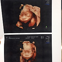 会看的宝妈宝爸们，帮忙看看我家的是小棉袄不？