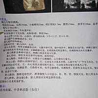 能看得出是男宝还是女宝吗