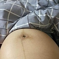 谁知道这个是什么，有没有什么办法去掉的？