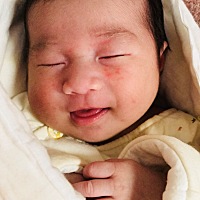 宝宝湿疹，在小红书上买的这个金盏花面霜有用吗？有用过的宝妈吗？求推荐有用的治湿疹的方法。空气晾不...