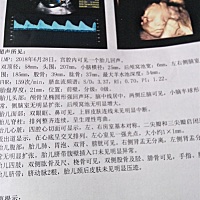 四维通过，好奇，有谁看懂男宝女？