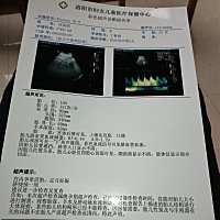 能看出来入骨盆了嘛  各位大神帮忙看一下