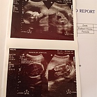 有看得懂的亲吗？帮忙看一下正常吗？