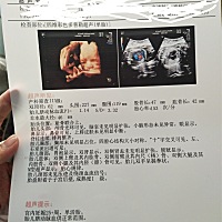 四维顺利通过，半个钟就搞定了，很好奇是男宝，还是女宝，会看的帮忙看看。