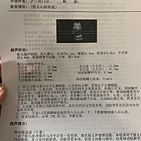 最后肺动脉反流少量，这个属于正常吗？