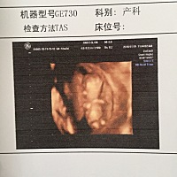 今天怀孕15 周了，孕吐貌消失了，但懒的很。一天就想躺着什么也不想干，大宝是女儿。每天很调皮…我知道...