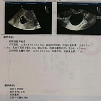 咨询下大家，6周，彩超检查结果，风险大吗？