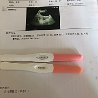 这是怀孕了么？请大家帮帮忙 ！大夫说太小了....看不出来