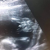 17周B超图，懂的亲帮忙看看男女