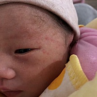 有没有宝妈知道这红色小坨坨是什么的吗？求解