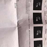 已经60多天了，孕酮也一直降，吃了那么多黄体酮，还打了针也是不行，到现在也没有胎心胎芽，做b超也才只...