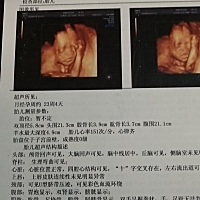 帮忙看看是男孩女孩