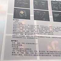 怀孕23周，四维很清楚，大家帮忙看看是男孩还是女孩，还有需要吃什么钙片