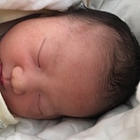 超过预产期九天顺转剖生的，怀孕期间皮肤超好，身材也没怎么走样，每天吃很多水果，宝宝生下来就白嫩嫩...