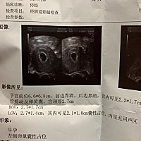 求助大家都来看下是女宝还是男宝，谢谢大家