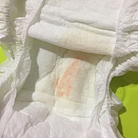 新生儿宝宝17天尿不湿上发现了橙红色，有宝妈知道这是怎么回事吗