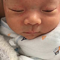 宝妈们谁知道宝宝脸上这是怎么回事？