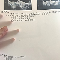 🈶会看的吗，7周左右